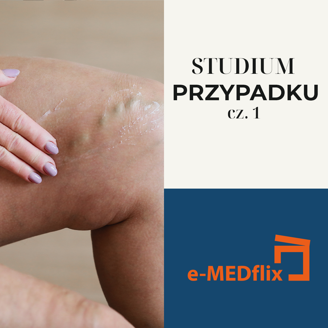 medflix_Leczenie chorób naczyń obwodowych_CS1.png